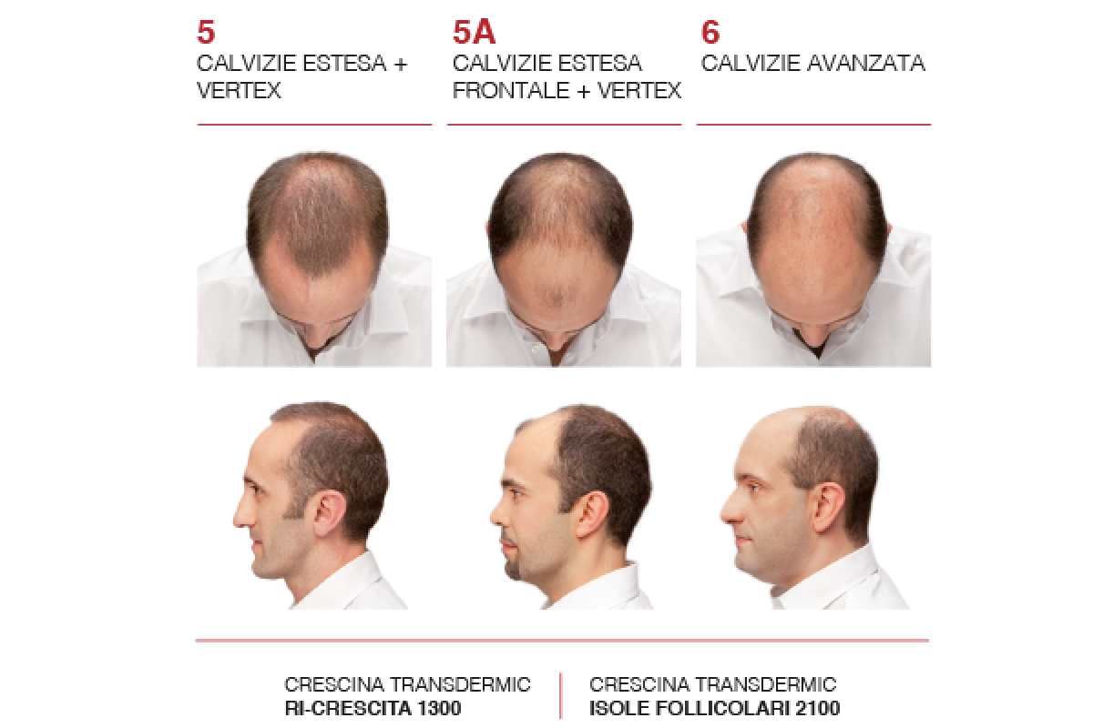 Crescina-AVANZATO_600x400