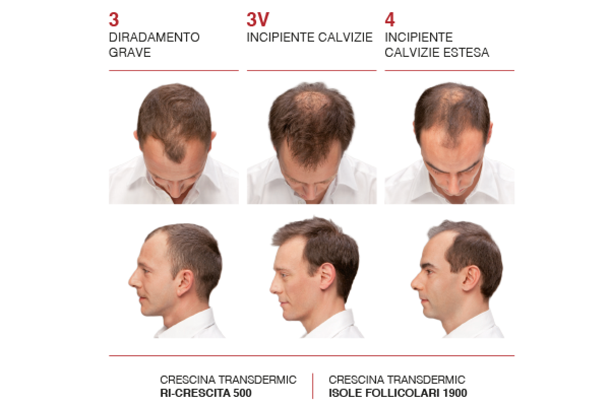 Crescina-GRADOMEDIO_600x400