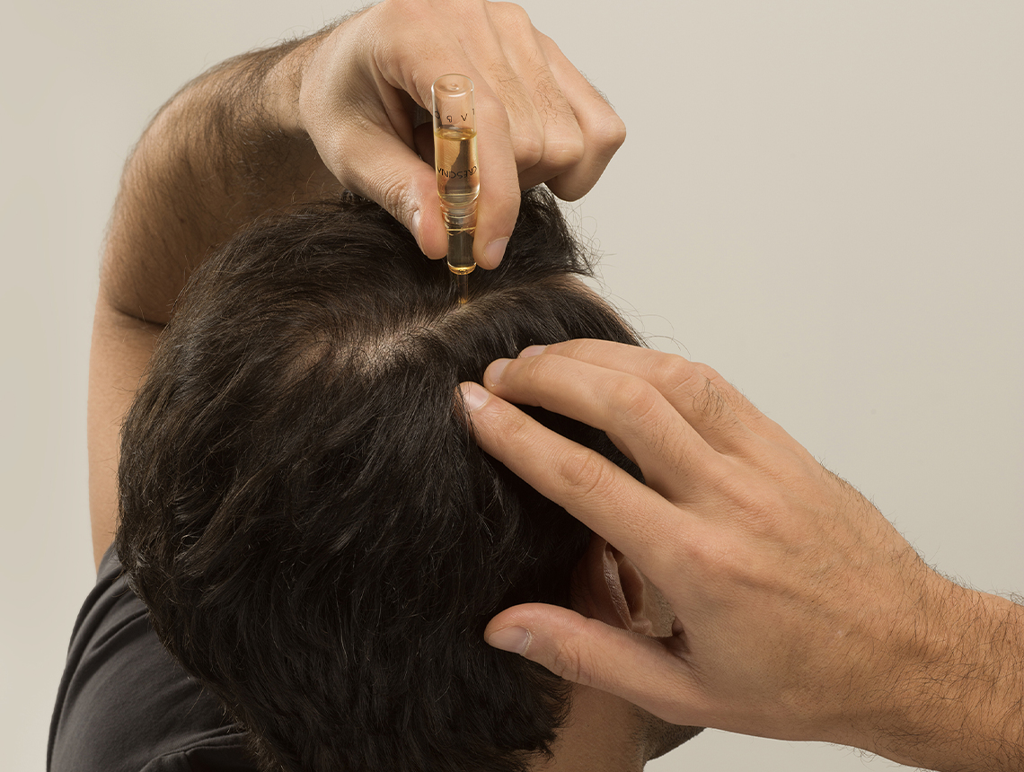 Crescina Labo Suisse – Application of the Hair Regrowth Vial