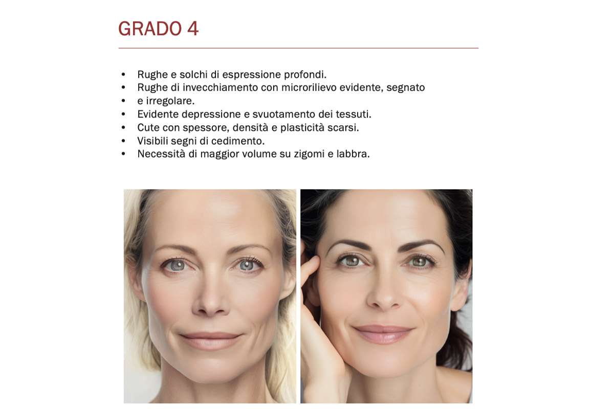 Fillerina – Fillerimetro Grado 4