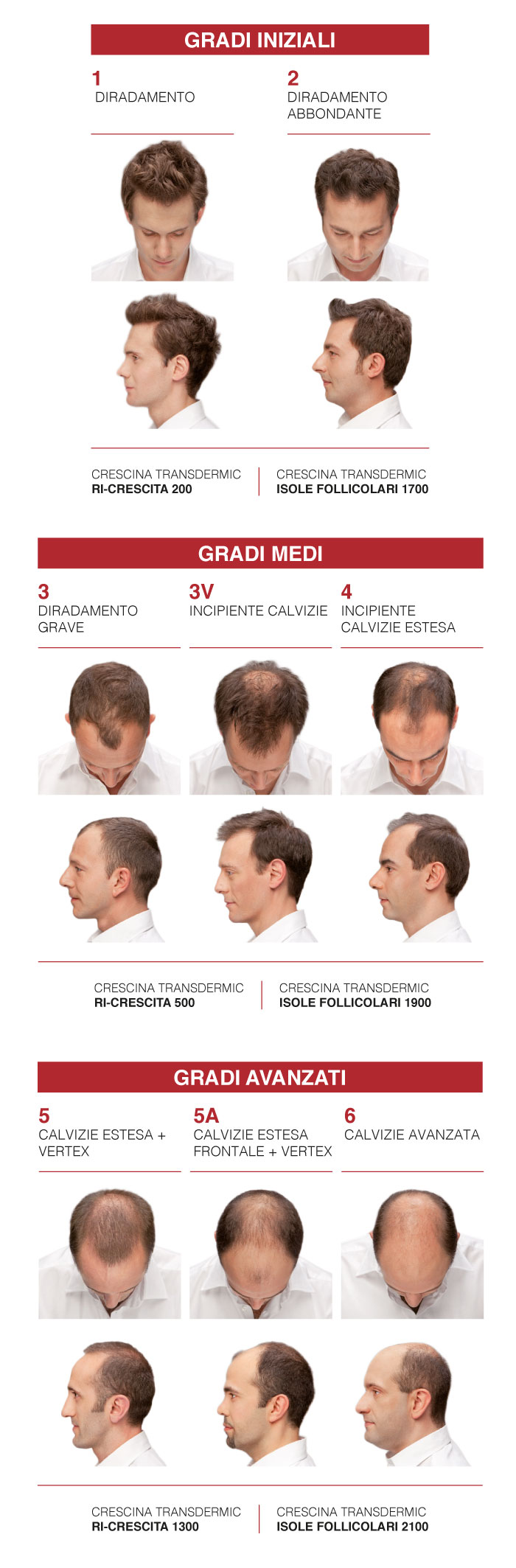 Diradometro: gradi di diradamento e calvizie maschile – Tabelle Crescina Labo Suisse
