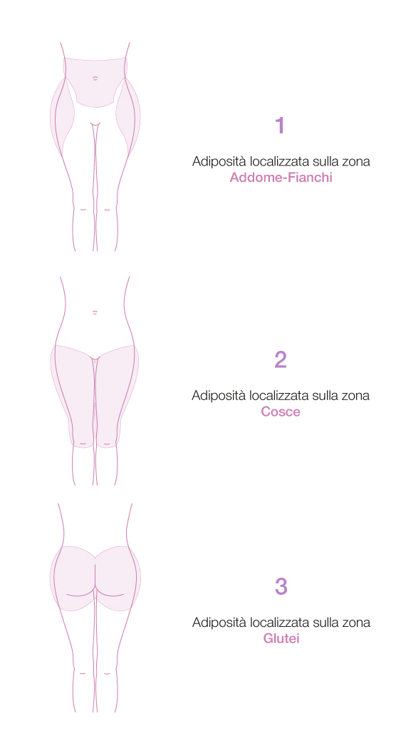 gradi-slimming-verticale