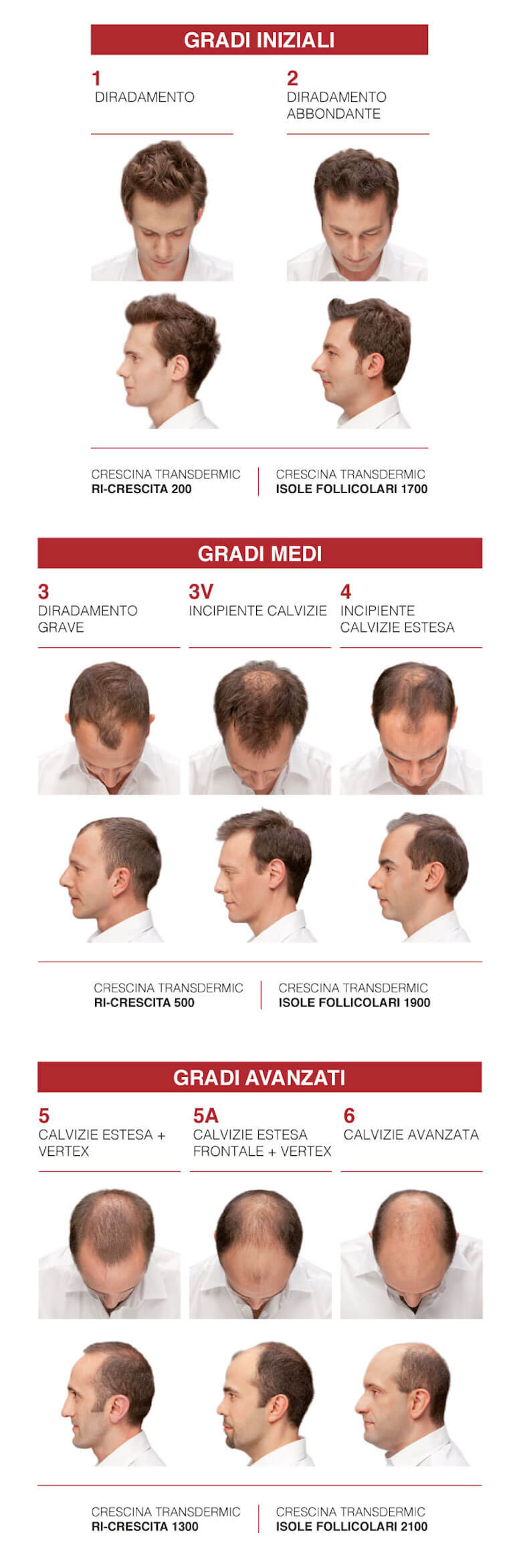 Diradometro: gradi di diradamento e calvizie maschile – Tabelle Crescina Labo Suisse