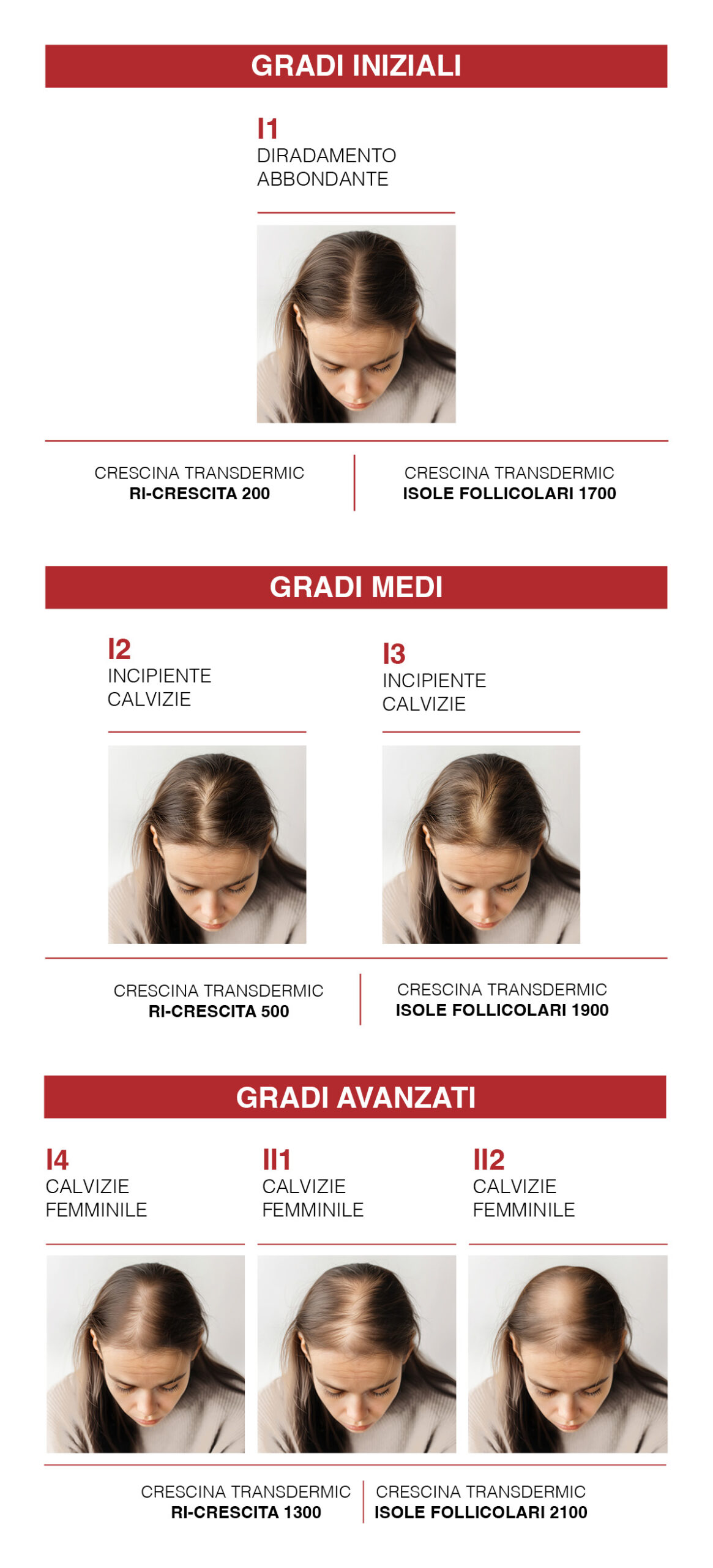 Scala di Diradamento femminile: Tabelle Crescina Labo Suisse