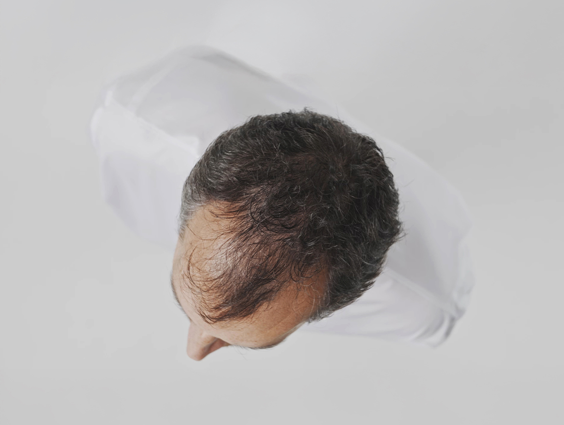 Crescina Superformula diradato