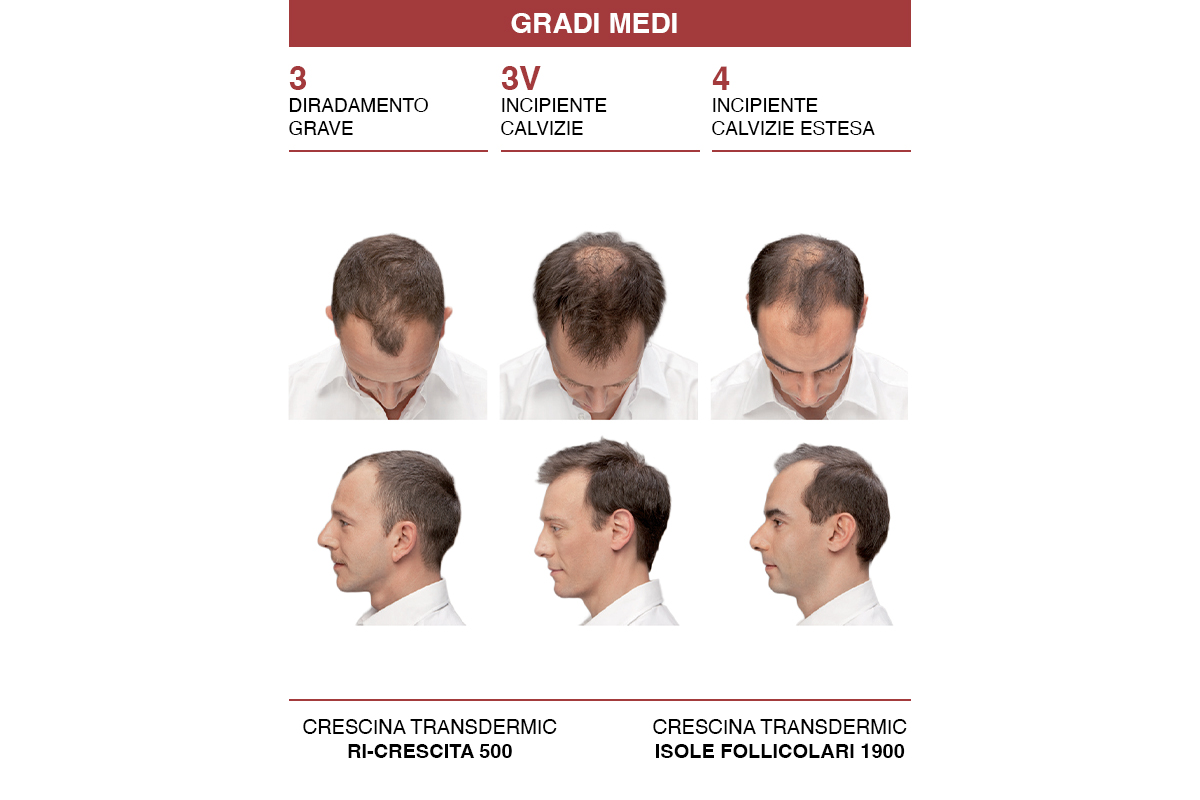 Crescina Diradometro – grado medio