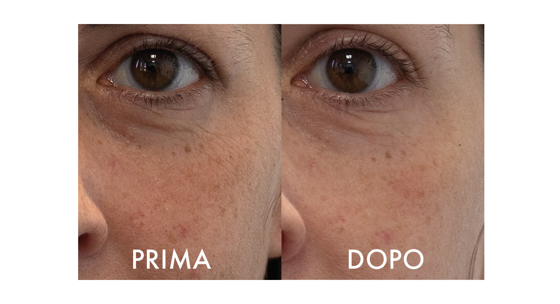 Collagenina Serum – pelle più compatta e levigata dopo 2 mesi