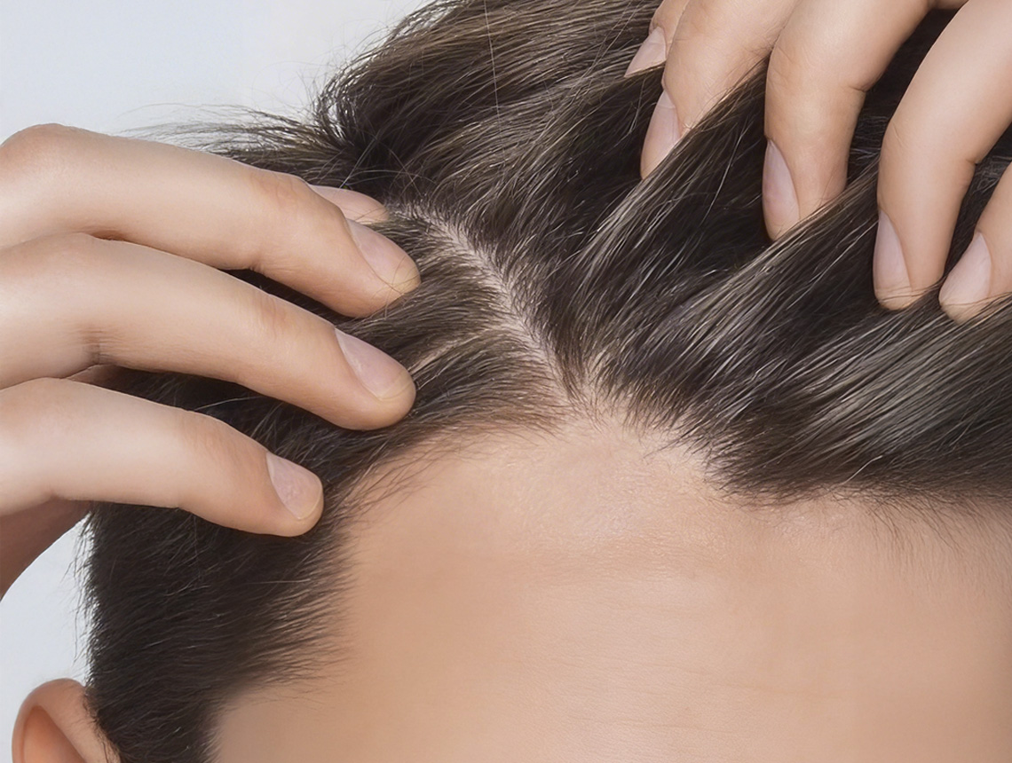 Crescina – trattamento anti-diradamento e ricrescita dei capelli