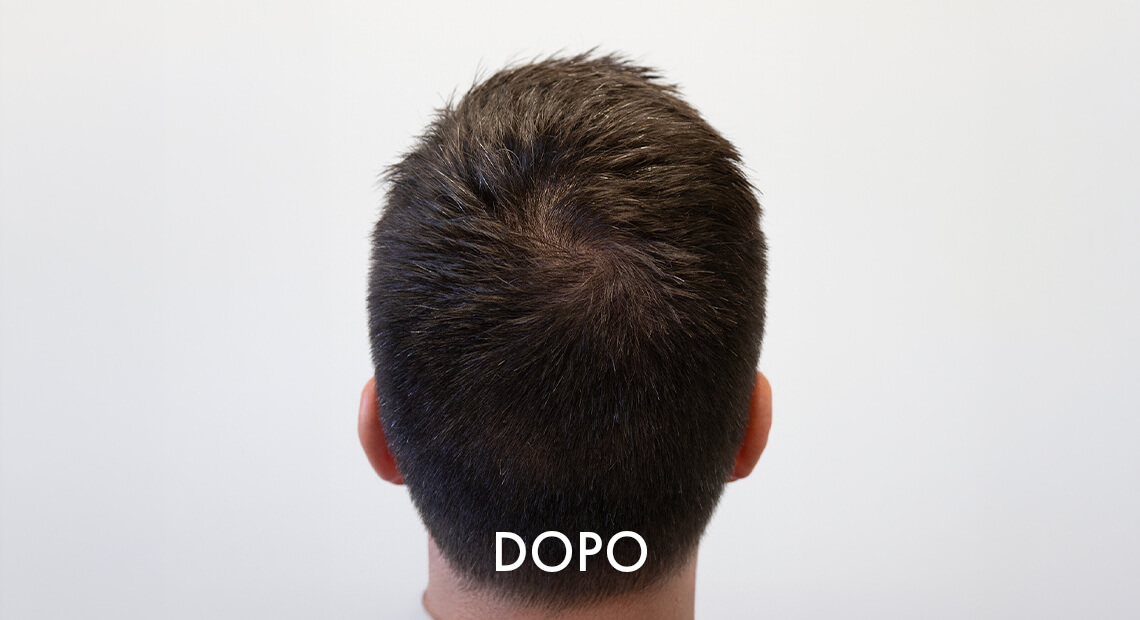 Uomo-Dopo