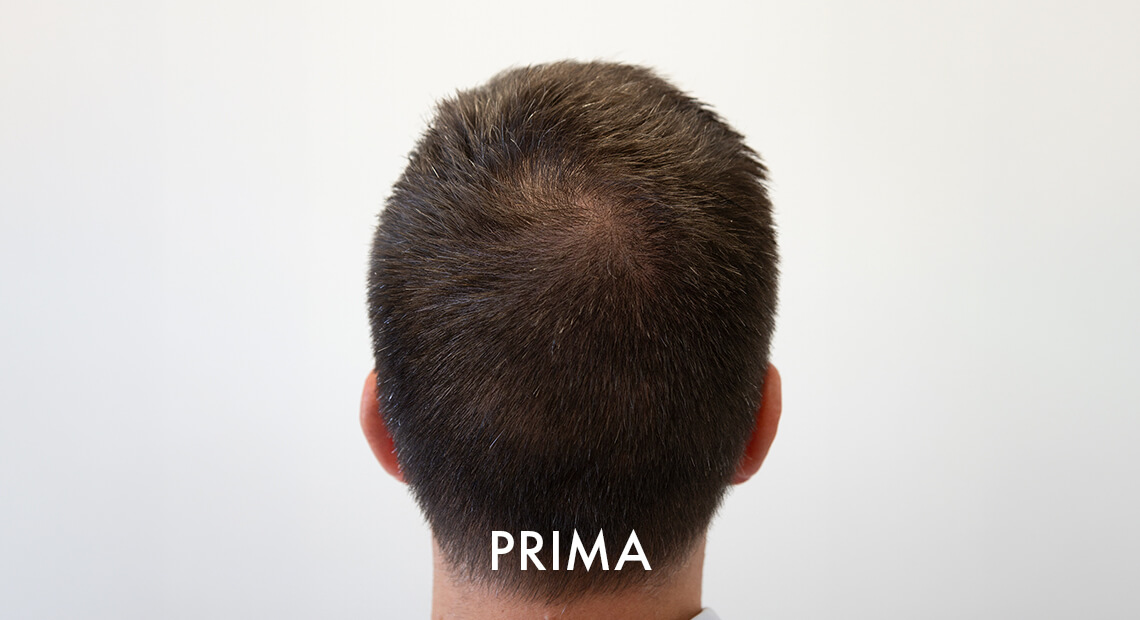 Uomo-Prima