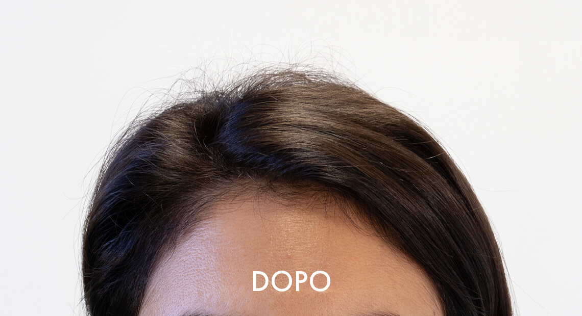 Donna-Dopo